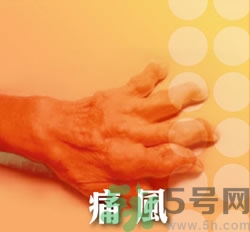 骨關(guān)節(jié)炎能治好嗎？骨關(guān)節(jié)炎平時注意事項