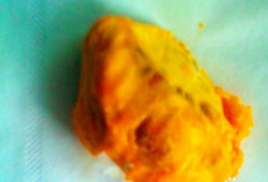 雞蛋果怎么吃？雞蛋果的籽可以吃嗎？