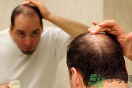 掉頭發(fā)需要檢查什么？脫發(fā)需要做什么檢查？