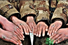 生凍瘡吃什么食物最好？預防凍瘡吃什么最有效？