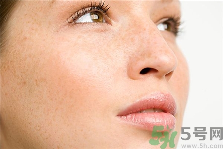 激光祛斑能洗臉嗎?激光祛斑后如何保養(yǎng)? 激光祛斑能洗臉嗎?激光祛斑后如何保養(yǎng)?