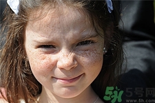 激光祛斑能洗臉嗎?激光祛斑后如何保養(yǎng)? 激光祛斑能洗臉嗎?激光祛斑后如何保養(yǎng)?