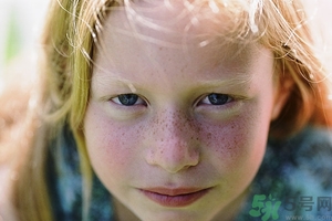 激光祛斑能洗臉嗎?激光祛斑后如何保養(yǎng)? 激光祛斑能洗臉嗎?激光祛斑后如何保養(yǎng)?