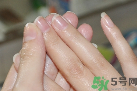 ?指甲上有豎紋是缺什么？指甲上有豎紋是缺維生素嗎？