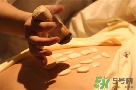 冬季艾灸有什么好處嗎？冬天艾灸需要注意什么？