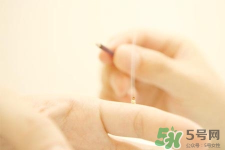 面癱能艾灸嗎？艾灸能治療面癱嗎？