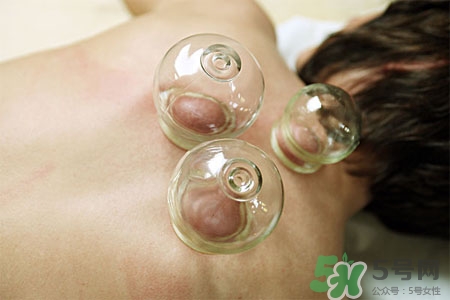 拔罐減肥為什么會(huì)反彈？拔罐減肥后不反彈的方法