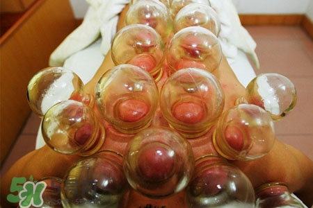拔罐后皮膚發(fā)癢是怎么回事？拔罐后為什么皮膚會癢？