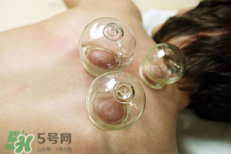 拔罐后皮膚發(fā)癢是怎么回事？拔罐后為什么皮膚會癢？