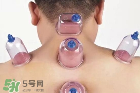 拔罐后可以喝酒嗎？拔罐后多久能喝酒？