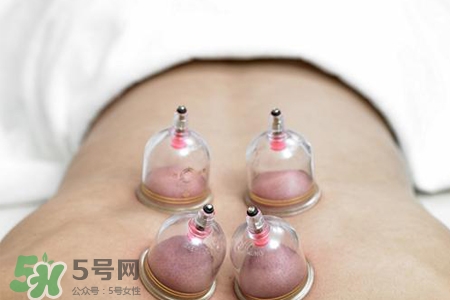 拔罐胃口會變好嗎？拔罐胃口變好怎么回事？