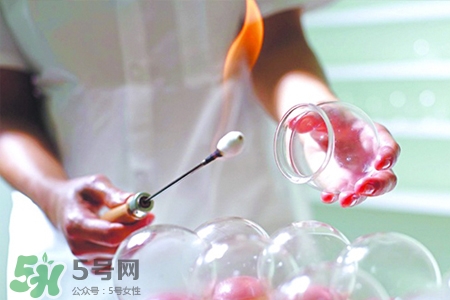 拔罐胃口會變好嗎？拔罐胃口變好怎么回事？