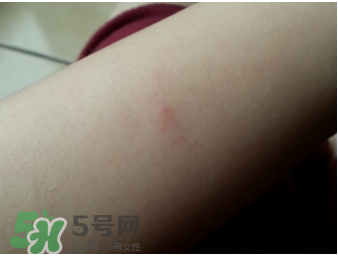 理膚泉b5修復(fù)霜怎么樣？理膚泉b5可以天天用嗎？