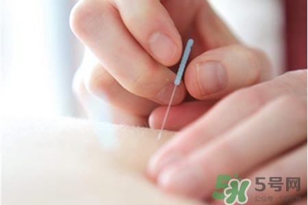 腰間盤突出可以針灸嗎？針灸能治腰間盤突出嗎？