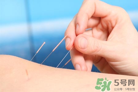 腰間盤突出可以針灸嗎？針灸能治腰間盤突出嗎？