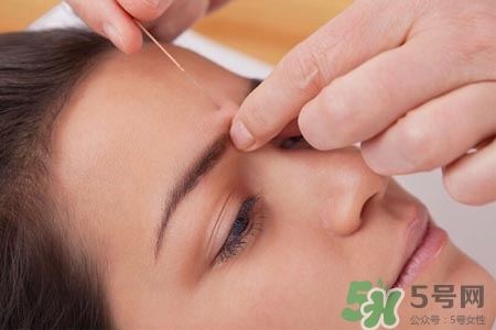 腰間盤突出可以針灸嗎？針灸能治腰間盤突出嗎？