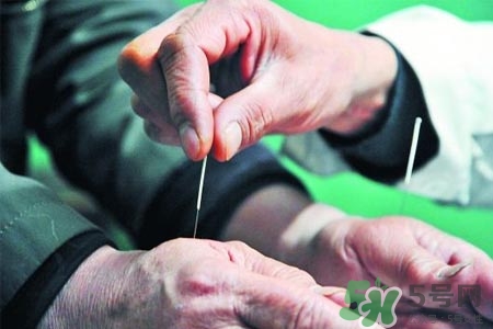 腰間盤突出可以針灸嗎？針灸能治腰間盤突出嗎？