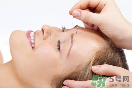 腰間盤突出可以針灸嗎？針灸能治腰間盤突出嗎？