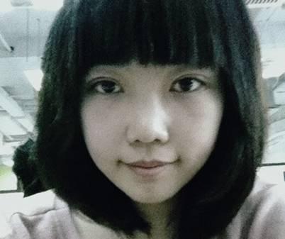 韓式三點雙眼皮是永久嗎？三點雙眼皮能保持多久？