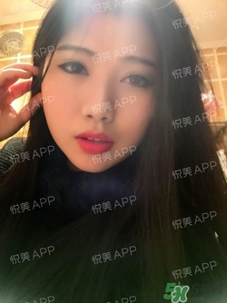 切開雙眼皮消腫過程圖_切開雙眼皮恢復(fù)過程圖 切開雙眼皮消腫過程圖_切開雙眼皮恢復(fù)過程圖