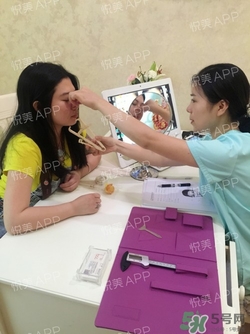 切開雙眼皮消腫過程圖_切開雙眼皮恢復(fù)過程圖 切開雙眼皮消腫過程圖_切開雙眼皮恢復(fù)過程圖