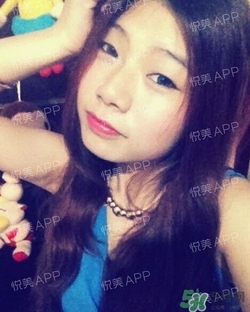 切開雙眼皮消腫過程圖_切開雙眼皮恢復(fù)過程圖 切開雙眼皮消腫過程圖_切開雙眼皮恢復(fù)過程圖