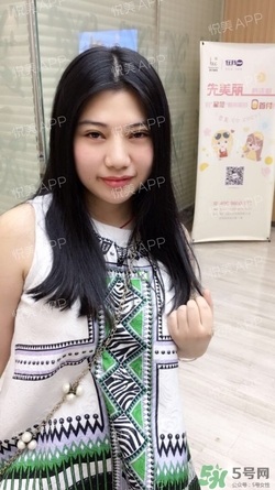 切開雙眼皮消腫過程圖_切開雙眼皮恢復(fù)過程圖 切開雙眼皮消腫過程圖_切開雙眼皮恢復(fù)過程圖