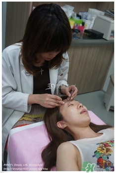 重瞼術(shù)多久能完全消腫 重瞼術(shù)恢復(fù)過(guò)程圖 重瞼術(shù)多久能完全消腫 重瞼術(shù)恢復(fù)過(guò)程圖