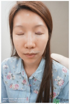 重瞼術(shù)多久能完全消腫 重瞼術(shù)恢復(fù)過(guò)程圖 重瞼術(shù)多久能完全消腫 重瞼術(shù)恢復(fù)過(guò)程圖