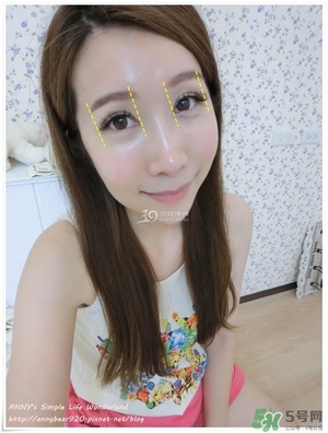 重瞼術(shù)多久能完全消腫 重瞼術(shù)恢復(fù)過(guò)程圖 重瞼術(shù)多久能完全消腫 重瞼術(shù)恢復(fù)過(guò)程圖