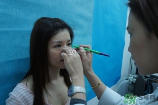 重瞼術(shù)是什么？重瞼術(shù)是永久的嗎？