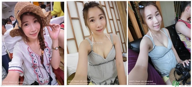 重瞼術(shù)多久能完全消腫 重瞼術(shù)恢復(fù)過(guò)程圖 重瞼術(shù)多久能完全消腫 重瞼術(shù)恢復(fù)過(guò)程圖