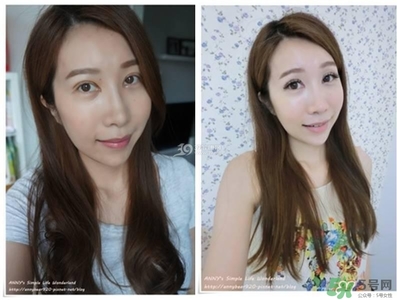 重瞼術(shù)多久能完全消腫 重瞼術(shù)恢復(fù)過(guò)程圖 重瞼術(shù)多久能完全消腫 重瞼術(shù)恢復(fù)過(guò)程圖