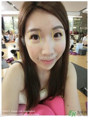 重瞼術(shù)多久能完全消腫 重瞼術(shù)恢復(fù)過(guò)程圖 重瞼術(shù)多久能完全消腫 重瞼術(shù)恢復(fù)過(guò)程圖