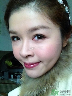 重瞼術(shù)是什么？重瞼術(shù)是永久的嗎？