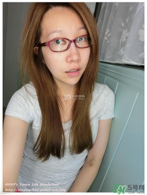 重瞼術(shù)多久能完全消腫 重瞼術(shù)恢復(fù)過(guò)程圖 重瞼術(shù)多久能完全消腫 重瞼術(shù)恢復(fù)過(guò)程圖