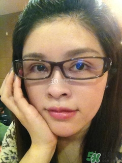 重瞼術(shù)是什么？重瞼術(shù)是永久的嗎？