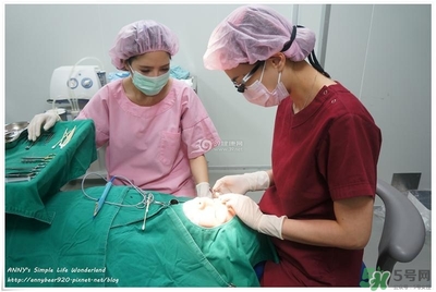 重瞼術(shù)多久能完全消腫 重瞼術(shù)恢復(fù)過(guò)程圖 重瞼術(shù)多久能完全消腫 重瞼術(shù)恢復(fù)過(guò)程圖