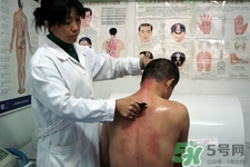 刮痧可以去濕氣嗎？體內(nèi)濕氣重刮痧有用嗎？