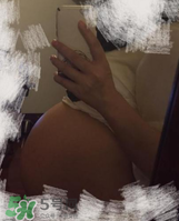 預(yù)防妊娠紋用什么好？懷孕期間如何預(yù)防妊娠紋