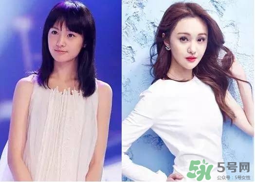 瘦臉針進(jìn)口好還是國(guó)產(chǎn)好？瘦臉針國(guó)產(chǎn)和進(jìn)口的區(qū)別