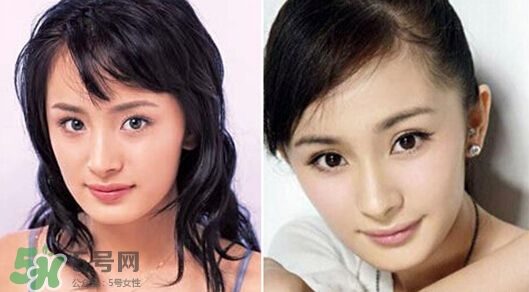 打瘦臉針能懷孕嗎？打瘦臉針能吃避孕藥嗎？