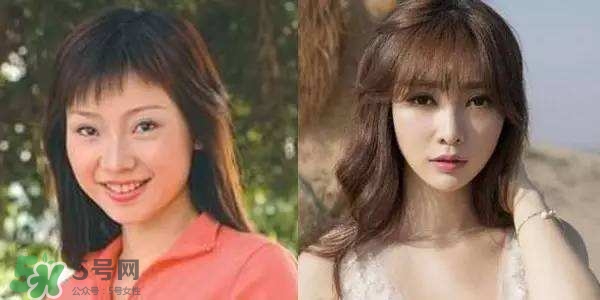 打瘦臉針能懷孕嗎？打瘦臉針能吃避孕藥嗎？