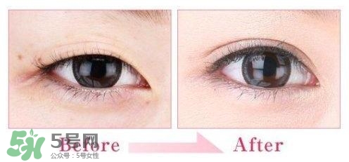 割雙眼皮多少錢？割雙眼皮最佳年齡