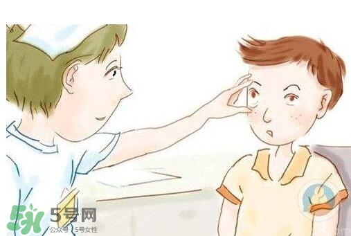 紅眼病用什么眼藥水好？紅眼病吃什么好得快