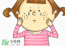 激光祛痘多長(zhǎng)時(shí)間能好?激光祛痘多久見(jiàn)效? 激光祛痘多長(zhǎng)時(shí)間能好?激光祛痘多久見(jiàn)效?