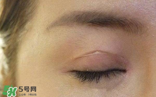 雙眼皮貼的正確貼法 雙眼皮貼怎么貼 雙眼皮貼的正確貼法 雙眼皮貼怎么貼