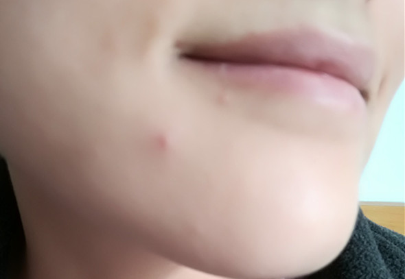 美康粉黛適合什么年齡？美康粉黛適合年齡段