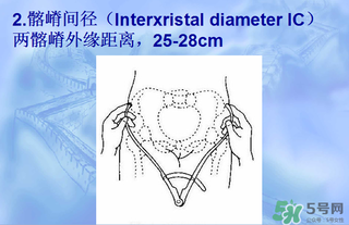 盆骨多大適合順產(chǎn) 盆骨多大可以順產(chǎn) 盆骨多大適合順產(chǎn) 盆骨多大可以順產(chǎn)