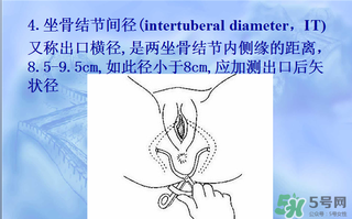 盆骨多大適合順產(chǎn) 盆骨多大可以順產(chǎn) 盆骨多大適合順產(chǎn) 盆骨多大可以順產(chǎn)